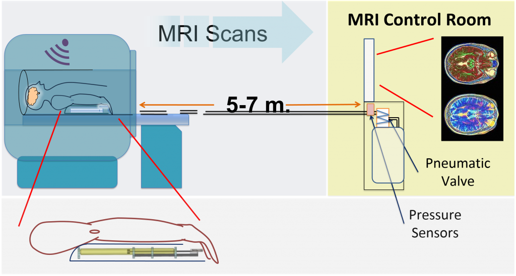 Rehabilitation via MRI Compatible Systems – Biorobotics and Human ...